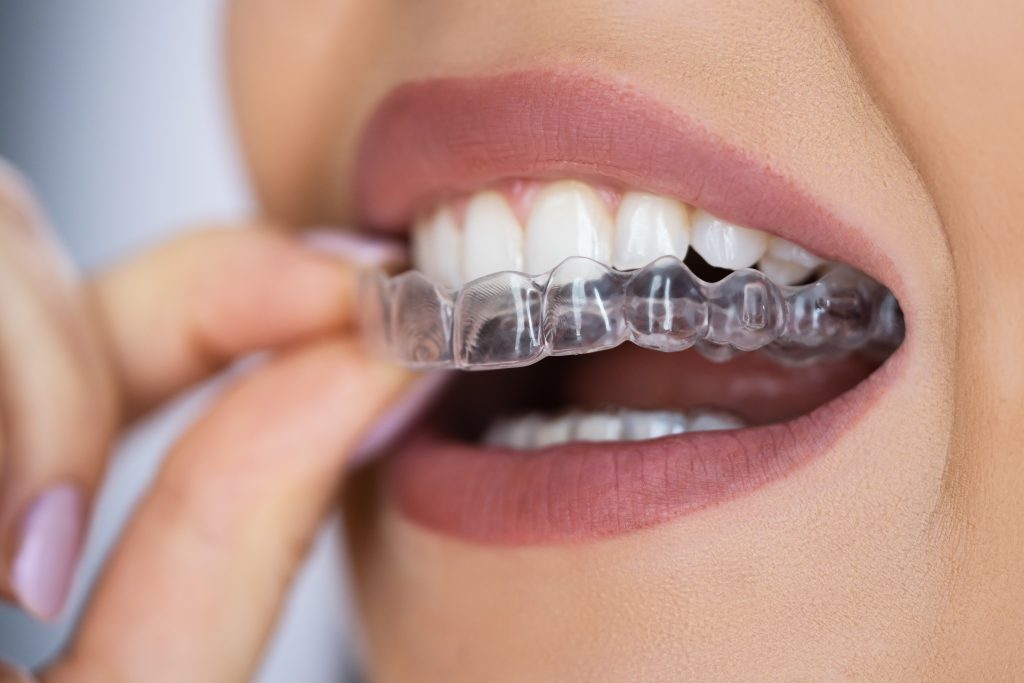 Preventive Dental Services